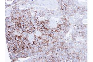 IHC-P Image Immunohistochemical analysis of paraffin-embedded SG xenograft, using alkaline phosphatase(intestinal), antibody at 1:100 dilution. (Intestinal Alkaline Phosphatase antibody)