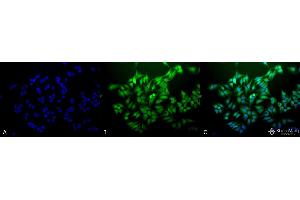 Immunocytochemistry/Immunofluorescence analysis using Mouse Anti-Ubiquitin Monoclonal Antibody, Clone 6C11-B3 . (Ubiquitin antibody  (Atto 390))