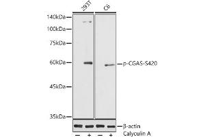 Western blot analysis of extracts of various cell lines, using Phospho-CGAS-S420 antibody (ABIN7266387) at 1:1000 dilution. (C6orf150 antibody  (pSer420))