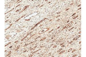 Immunohistochemistry analysis using Rabbit Anti-FNP1 Polyclonal Antibody (ABIN5066852). (FNIP1 antibody  (HRP))