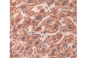 Used in DAB staining on fromalin fixed paraffin- embedded liver tissue (ABCA8 antibody  (AA 1263-1456))
