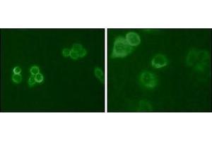 Immunofluorescence analysis of Hela (Left) and MCF-7 (Right) cells using Tyro3 antibody (green).