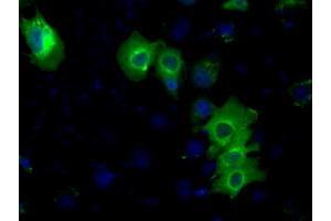 Immunofluorescence (IF) image for anti-Protein Kinase, CAMP-Dependent, Regulatory, Type II, alpha (PRKAR2A) antibody (ABIN1500255)