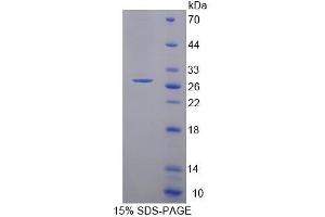 SDS-PAGE (SDS) image for Protocadherin alpha 1 (PCDHA1) (AA 31-243) protein (His tag) (ABIN4988776)