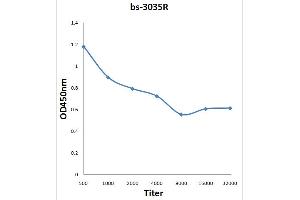 Formalin-fixed and paraffin embedded human lung carcinoma labeled with Anti-Phospho-ATP1A1(Ser16) Polyclonal Antibody, Unconjugated (ABIN683188) at 1:200 followed by conjugation to the secondary antibody and DAB staining. (ATP1A1 antibody  (pSer16))