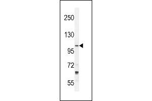 TLL2 Antibody (N-term) (ABIN392519 and ABIN2842079) western blot analysis in NCI- cell line lysates (35 μg/lane). (Tolloid-Like 2 antibody  (N-Term))