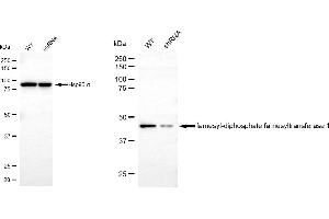 anti-Farnesyl-Diphosphate Farnesyltransferase 1 (FDFT1) antibody