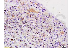 Formalin-fixed and paraffin embedded rat pancreas labeled with Rabbit Anti Integrin Alpha 3 + Beta 1 Polyclonal Antibody, Unconjugated (ABIN737031) at 1:200 followed by conjugation to the secondary antibody and DAB staining (Integrin Alpha3, Beta1 (AA 976-1025) antibody)