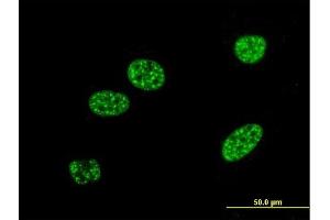 Immunofluorescence of monoclonal antibody to BNIP3L on HeLa cell. (BNIP3L/NIX antibody  (AA 43-130))