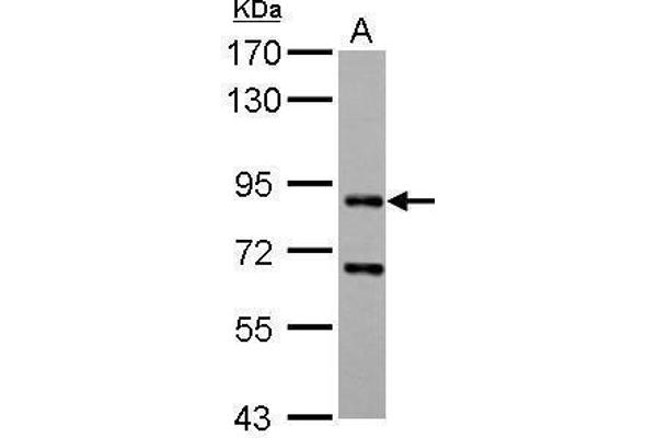 CD2AP antibody