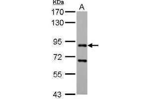WB Image CD2AP antibody detects CD2AP protein by Western blot analysis. (CD2AP antibody)