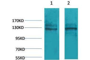 Western Blotting (WB) image for anti-Calcium-Sensing Receptor (CASR) antibody (ABIN3181546)