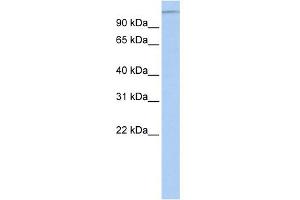 MTUS1 antibody  (Middle Region)