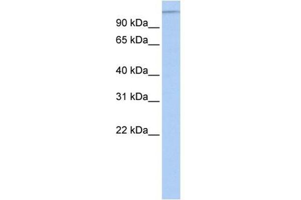 MTUS1 antibody  (Middle Region)