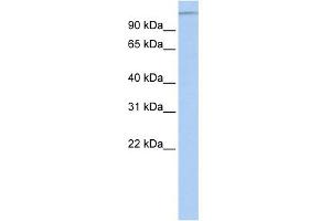 WB Suggested Anti-MTUS1 Antibody Titration:  0. (MTUS1 antibody  (Middle Region))