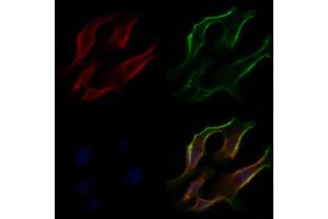 ABIN6266305 and ABIN6277424 staining Hela cells by IF/ICC. (PDK4 antibody  (C-Term))