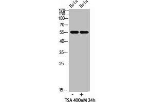 Western blot analysis of hela cells,hela cells, antibody was diluted at 500. (HNF4A antibody  (acLys106))