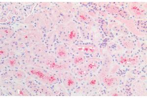 ABIN184784 (5 μg/mL) staining of paraffin embedded Human Kidney. (CBR1 antibody  (C-Term))