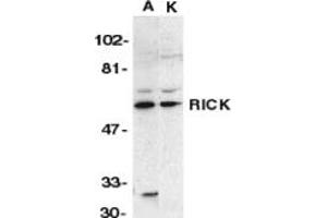Image no. 1 for anti-Receptor-Interacting Serine-threonine Kinase 2 (RIPK2) (N-Term) antibody (ABIN201933) (RIPK2 antibody  (N-Term))