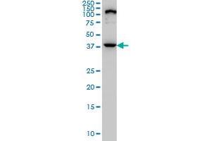 ELAC1 monoclonal antibody (M01), clone 1G2 Western Blot analysis of ELAC1 expression in PC-12 . (ELAC1 antibody  (AA 282-362))