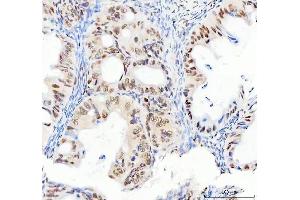 IHC analysis of DDX1 using anti-DDX1 antibody (ABIN7602050). (DDX1 antibody  (AA 562-740))