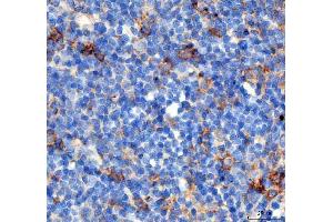 IHC analysis of PDCD1 using anti PDCD1 antibody (ABIN5518784). (PD-1 antibody  (N-Term))