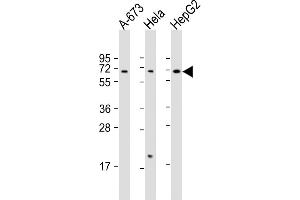 All lanes : Anti-CHRNA4 Antibody (C-Term) at 1:2000 dilution Lane 1: A-673 whole cell lysate Lane 2: Hela whole cell lysate Lane 3: HepG2 whole cell lysate Lysates/proteins at 20 μg per lane. (CHRNA4 antibody  (AA 472-503))