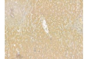 ABIN6261113 and ABIN6277549 at 1/100 staining human normal liver tissue by IHC-P.
