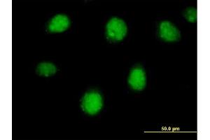 Immunofluorescence of purified MaxPab antibody to RARB on HeLa cell. (Retinoic Acid Receptor beta antibody  (AA 1-448))