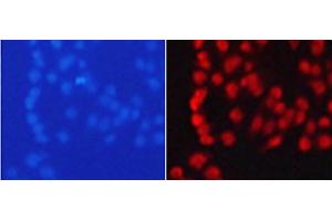Immunofluorescence analysis of 293T cells using TriMethyl-Histone H3-K9 Polyclonal Antibody