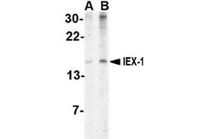 Western blot analysis of IEX1 in human brain tissue lysate with AP30400PU-N IEX1 antibody at (A) 2 and (B) 4 μg/ml.