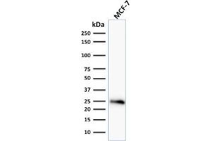 Western Blot Analysis of human MCF-7 cell lysate using Bcl-2 Mouse Monoclonal Antibody (BCL2/796). (Bcl-2 antibody)