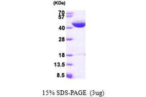 SDS-PAGE (SDS) image for Isovaleryl-CoA Dehydrogenase (IVD) (AA 33-426) protein (His tag) (ABIN666949)