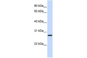 WB Suggested Anti-TGIF2LX Antibody Titration:  0. (TGIF2LX antibody  (Middle Region))