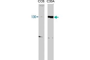 RBL2 monoclonal antibody, clone KAB40  recognizes both the phosphorylated and unphosphorylated forms of p130 at aMW of 130kDa. (p130 antibody  (N-Term))