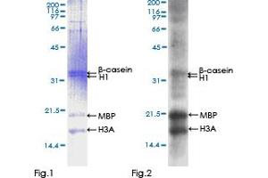 Western Blotting (WB) image for FYN Oncogene Related To SRC, FGR, YES (FYN) (AA 1-482) protein (GST tag) (ABIN1354567) (FYN Protein (AA 1-482) (GST tag))