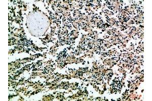 Immunohistochemical analysis of paraffin-embedded Human-spleen, antibody was diluted at 1:100 (CD52 antibody  (AA 20-50))