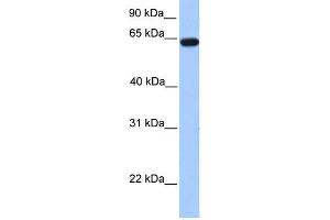WB Suggested Anti-ZNF342 Antibody Titration:  0. (Zinc Finger Protein 296 (ZNF296) (N-Term) antibody)