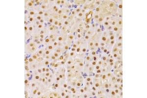 Immunohistochemistry (IHC) image for anti-Cell Division Cycle 25 Homolog A (S. Pombe) (CDC25A) (AA 235-484) antibody (ABIN3021626)