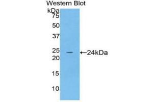 Western Blotting (WB) image for anti-Spectrin alpha Chain, Brain (SPTAN1) (AA 22-210) antibody (ABIN1860637) (SPTAN1 antibody  (AA 22-210))