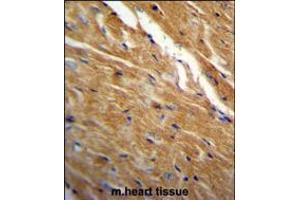 TBC1D13 Antibody immunohistochemistry analysis in formalin fixed and paraffin embedded mouse heart tissue followed by peroxidase conjugation of the secondary antibody and DAB staining.