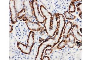 IHC-P: SLC22A6 antibody testing of rat kidney tissue (SLC22A6 antibody  (AA 534-550))