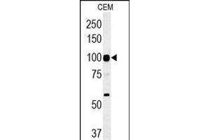 ATP6V0A4 Antibody (Center) (ABIN651562 and ABIN2840303) western blot analysis in CEM cell line lysates (35 μg/lane).