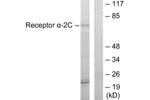 Western blot analysis of extracts from HepG2 cells, using Adrenergic Receptor alpha -2C antibody. (ADRA2C antibody  (C-Term))