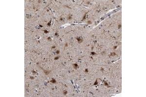 Immunohistochemical staining of human cerebral cortex with KIAA1429 polyclonal antibody  shows strong nuclear and cytoplasmic positivity in neuronal cells at 1:10-1:20 dilution.