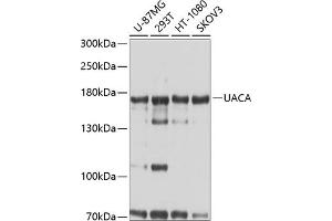 Western blot analysis of extracts of various cell lines, using UACA antibody  at 1:1000 dilution. (UACA antibody  (AA 1-90))