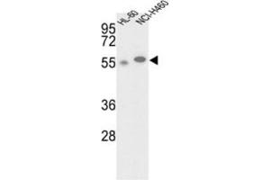 Western Blotting (WB) image for anti-Galactokinase 2 (GALK2) antibody (ABIN3002978) (GALK2 antibody)