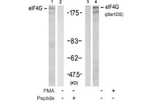 Image no. 2 for anti-Eukaryotic Translation Initiation Factor 4 Gamma, 1 (EIF4G1) (pSer1232) antibody (ABIN319277) (EIF4G1 antibody  (pSer1232))