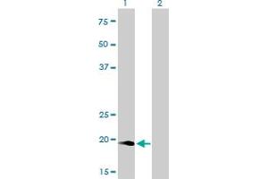 NUDT10 antibody  (AA 1-164)