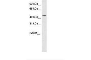 Image no. 1 for anti-High Mobility Group 20B (HMG20B) (N-Term) antibody (ABIN6736097)